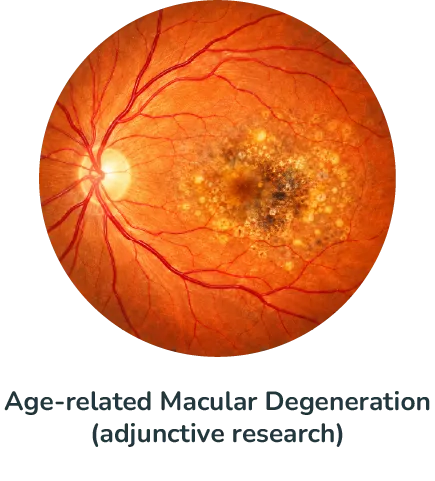 Age-related Macular Degeneration (adjunctive research)@4x