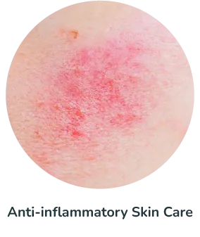 Anti-inflammatory Skin Care