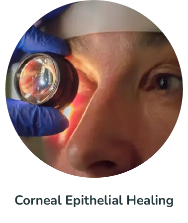Corneal Epithelial Healing