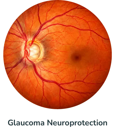 Glaucoma Neuroprotection@4x