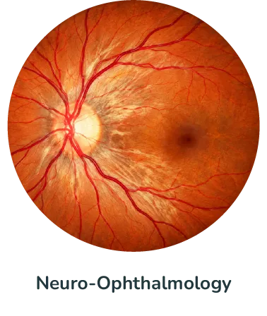 Neuro-Ophthalmology@4x