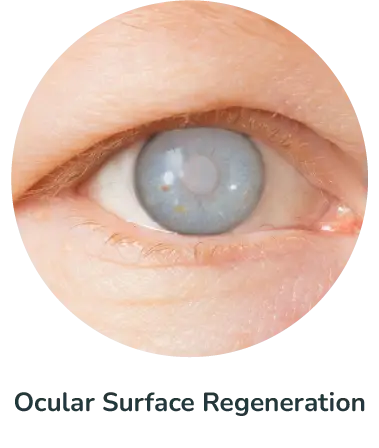 Ocular Surface Regeneration
