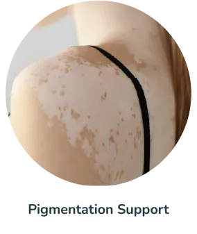 Pigmentation Support