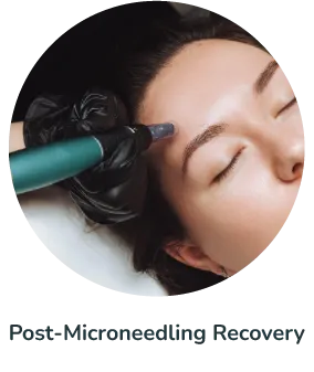 Post-Microneedling Recovery