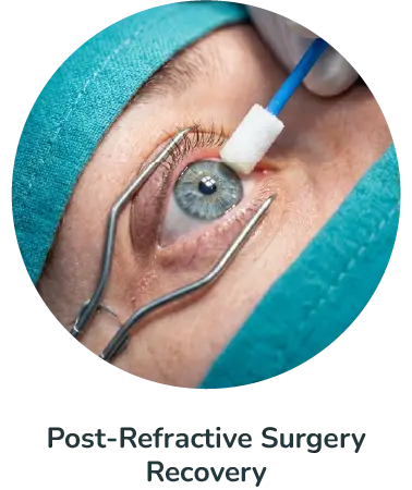 Post-Refractive Surgery Recovery