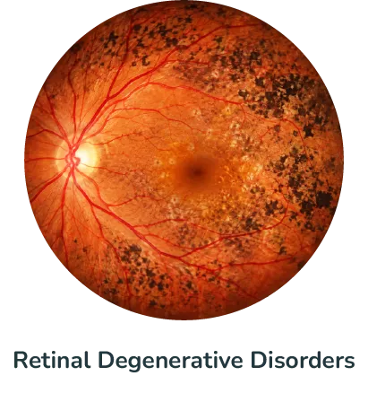 Retinal Degenerative Disorders@4x
