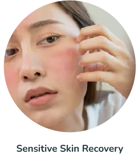 Sensitive Skin Recovery